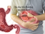 Viêm dạ dày là một vấn đề sức khỏe phổ biến và có thể gây khó chịu. Dưới đây là một số lời khuyên để giúp bạn quản lý và giảm triệu chứng viêm dạ dày: