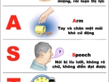 LÀM THẾ NÀO ĐỂ PHÁT HIỆN ĐỘT QUỴ NÃO?