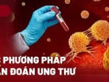 Chẩn đoán ung bướu chuẩn xác - Đồng hành sức khỏe