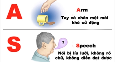 LÀM THẾ NÀO ĐỂ PHÁT HIỆN ĐỘT QUỴ NÃO?