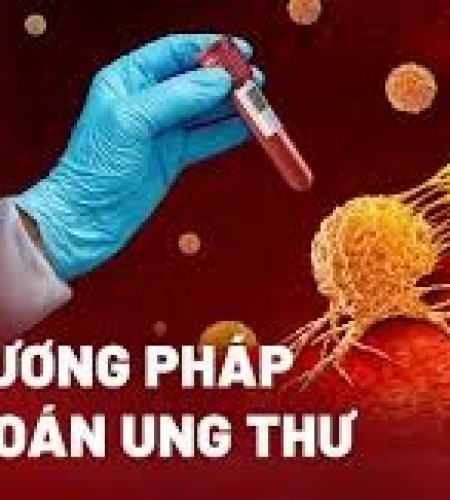 Giới thiệu